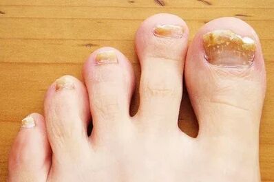 Nails